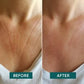 ABRIKOZEN Decolleté Pad Vitamine C “décolleté delight”- Verjong & hydrateer met de Vitamine C Decolleté Pad - 30 behandelingen