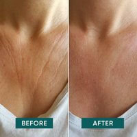 ABRIKOZEN Decolleté Pad Vitamine C “décolleté delight”- Verjong & hydrateer met de Vitamine C Decolleté Pad - 30 behandelingen